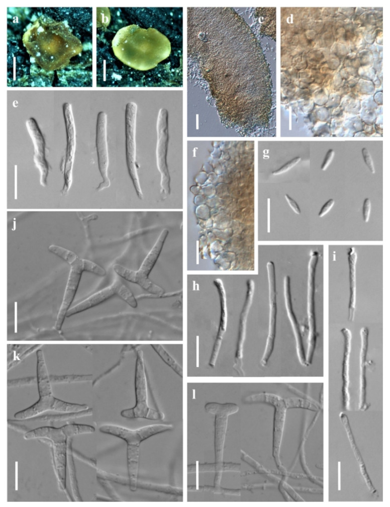 Four New Species and New Records of Orbilia from China Based on Molecular and Morphological Data.