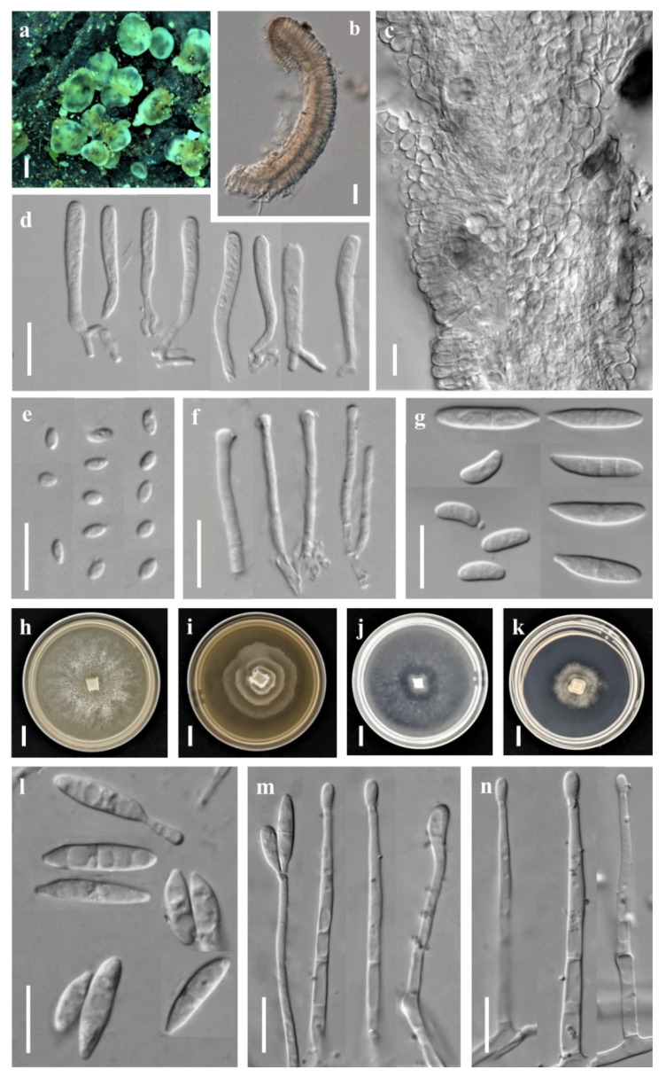 Four New Species and New Records of Orbilia from China Based on Molecular and Morphological Data.