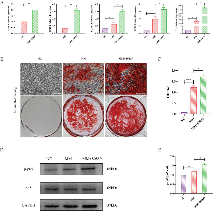 NBCe1 Regulates Odontogenic Differentiation of Human Dental Pulp Stem Cells via NF-<i>κ</i>B.