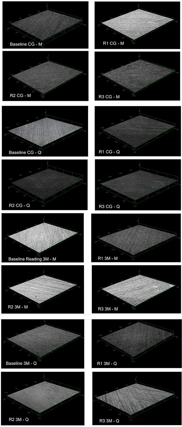 Surface gloss, gloss retention, and color stability of 2 nano-filled universal resin composites.