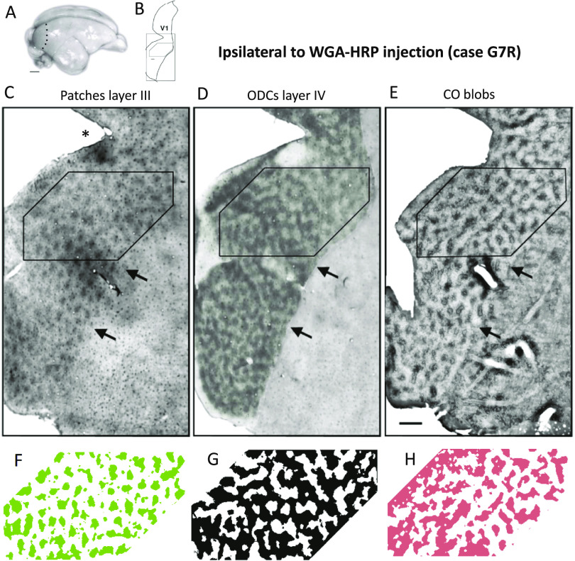 Overall patterns of eye-specific retino-geniculo-cortical projections to layers III, IV, and VI in primary visual cortex of the greater galago (<i>Otolemur crassicudatus</i>), and correlation with cytochrome oxidase blobs.