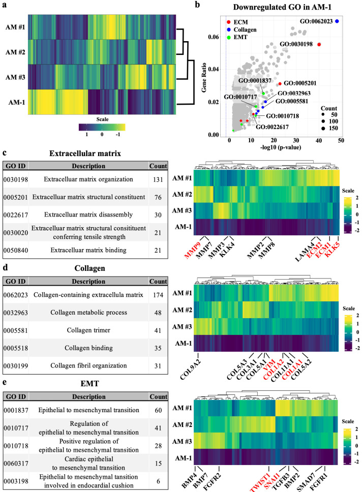 Transcriptomic Comparison Analysis between Ameloblastoma and AM-1 Cell Line.