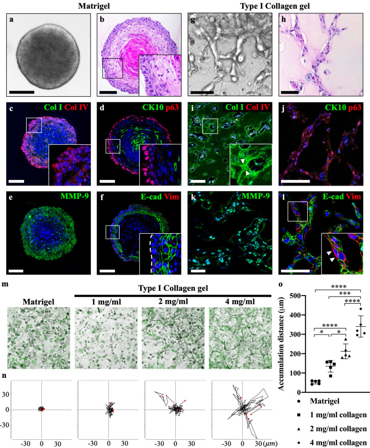 Transcriptomic Comparison Analysis between Ameloblastoma and AM-1 Cell Line.