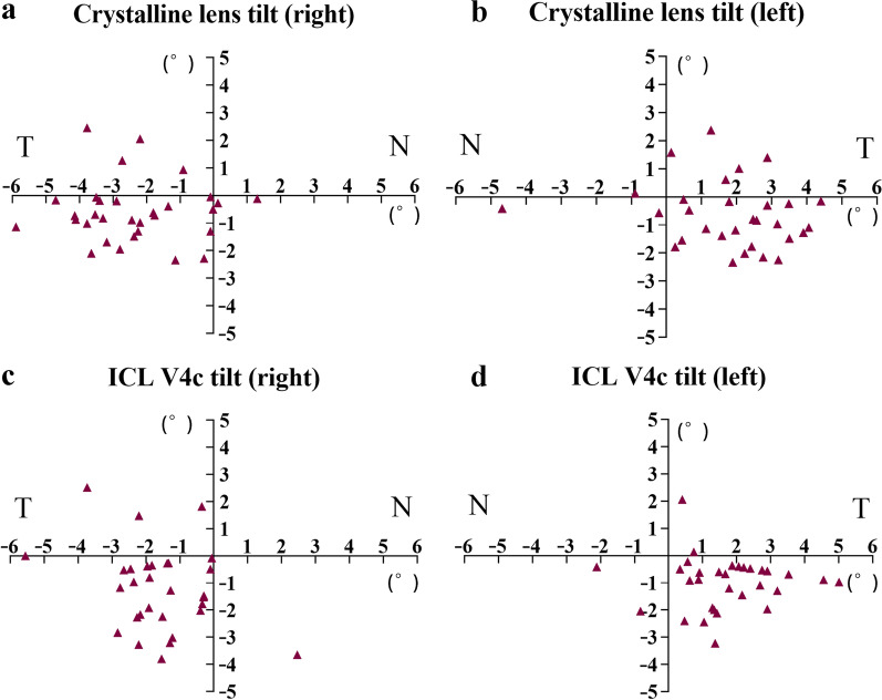 Effects of lighting conditions and accommodation on the three-dimensional position of Visian implantable collamer lens.