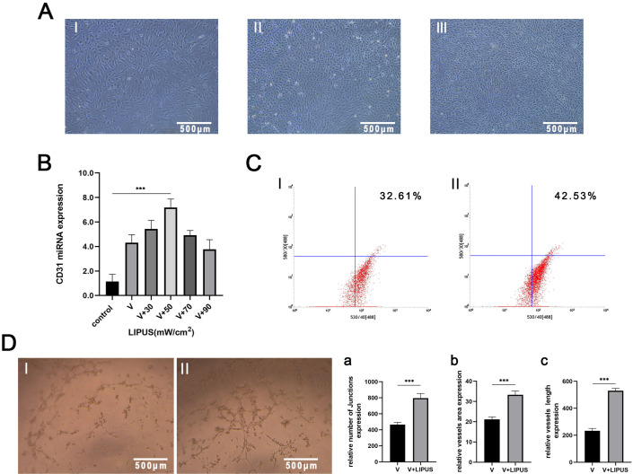 LIPUS Promotes Endothelial Differentiation and Angiogenesis of Periodontal Ligament Stem Cells by Activating Piezo1.