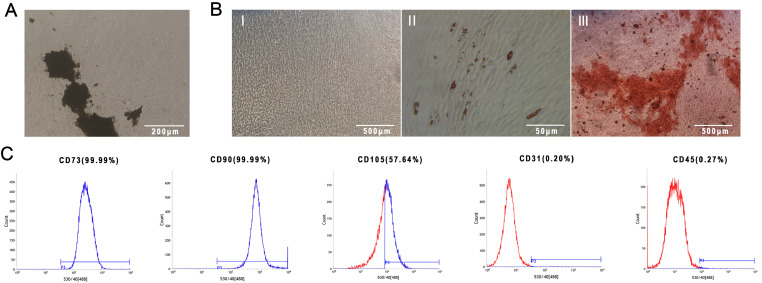 LIPUS Promotes Endothelial Differentiation and Angiogenesis of Periodontal Ligament Stem Cells by Activating Piezo1.