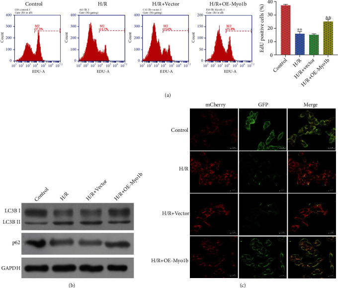 Myosin 1b Participated in the Modulation of Hypoxia/Reoxygenation-Caused H9c2 Cell Apoptosis and Autophagy.