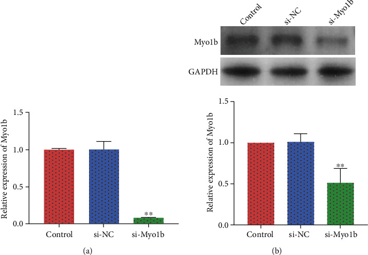 Myosin 1b Participated in the Modulation of Hypoxia/Reoxygenation-Caused H9c2 Cell Apoptosis and Autophagy.