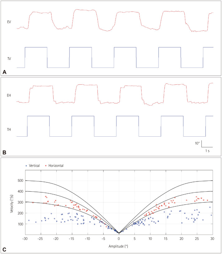Vertical Saccadic Slowing in Episodic Ataxia Type 2.