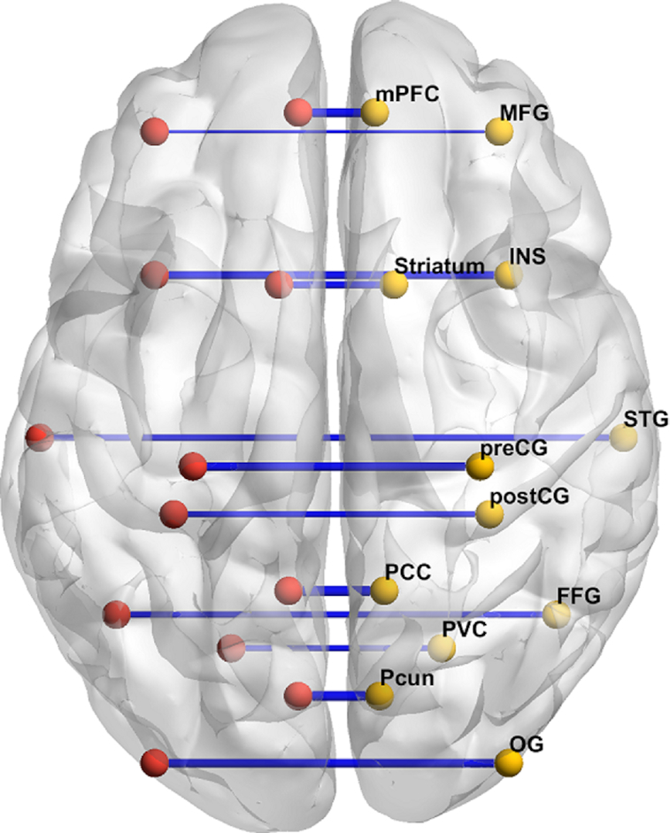 Reduced homotopic interhemispheric connectivity in psychiatric disorders: evidence for both transdiagnostic and disorder specific features.
