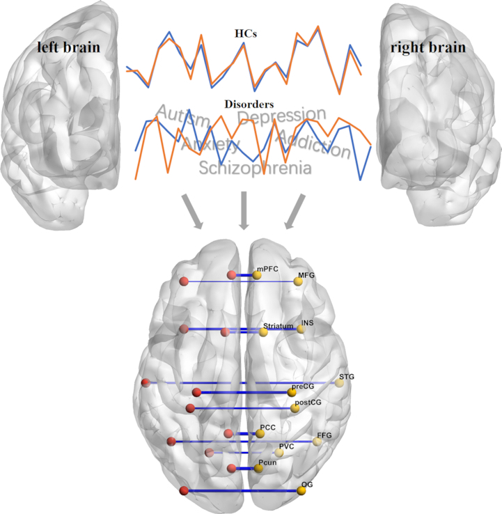 Reduced homotopic interhemispheric connectivity in psychiatric disorders: evidence for both transdiagnostic and disorder specific features.