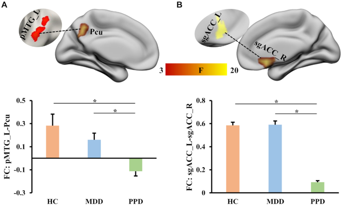 Postpartum depression and major depressive disorder: the same or not? Evidence from resting-state functional MRI.