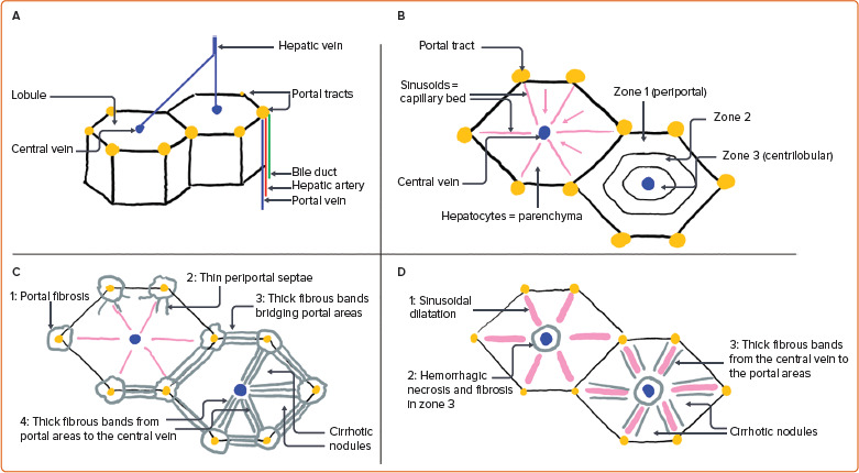 Fontan-associated Liver Disease in Adults: What a Cardiologist Needs to Know. A Comprehensive Review for Clinical Practitioners.