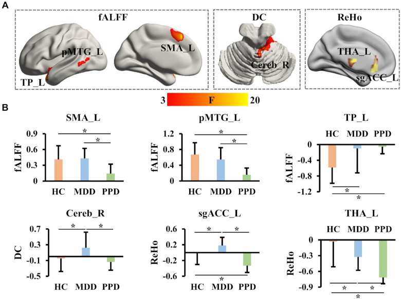 Postpartum depression and major depressive disorder: the same or not? Evidence from resting-state functional MRI.