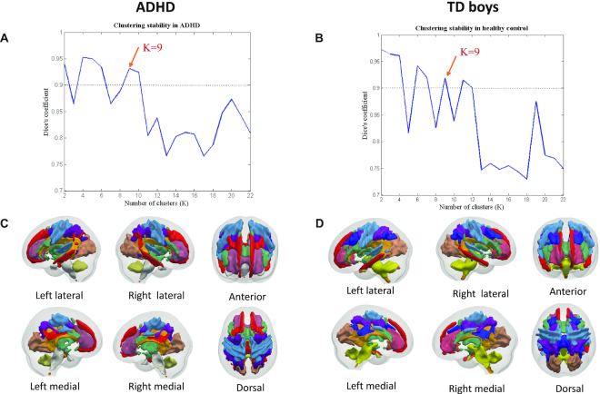 Investigation of white matter functional networks underlying different behavioral profiles in attention-deficit/hyperactivity disorder.