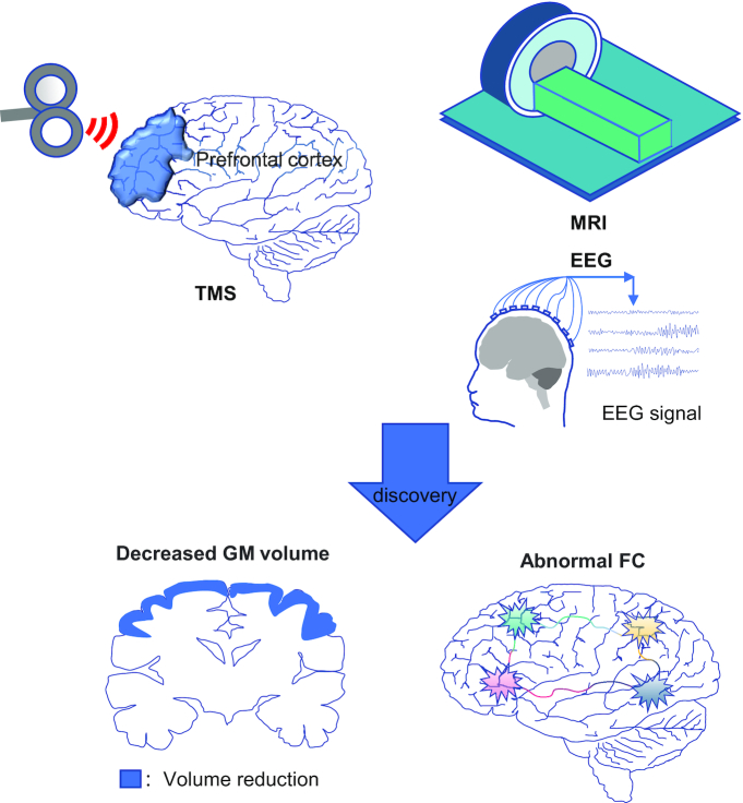 Advances in neuroimaging studies of alcohol use disorder (AUD).