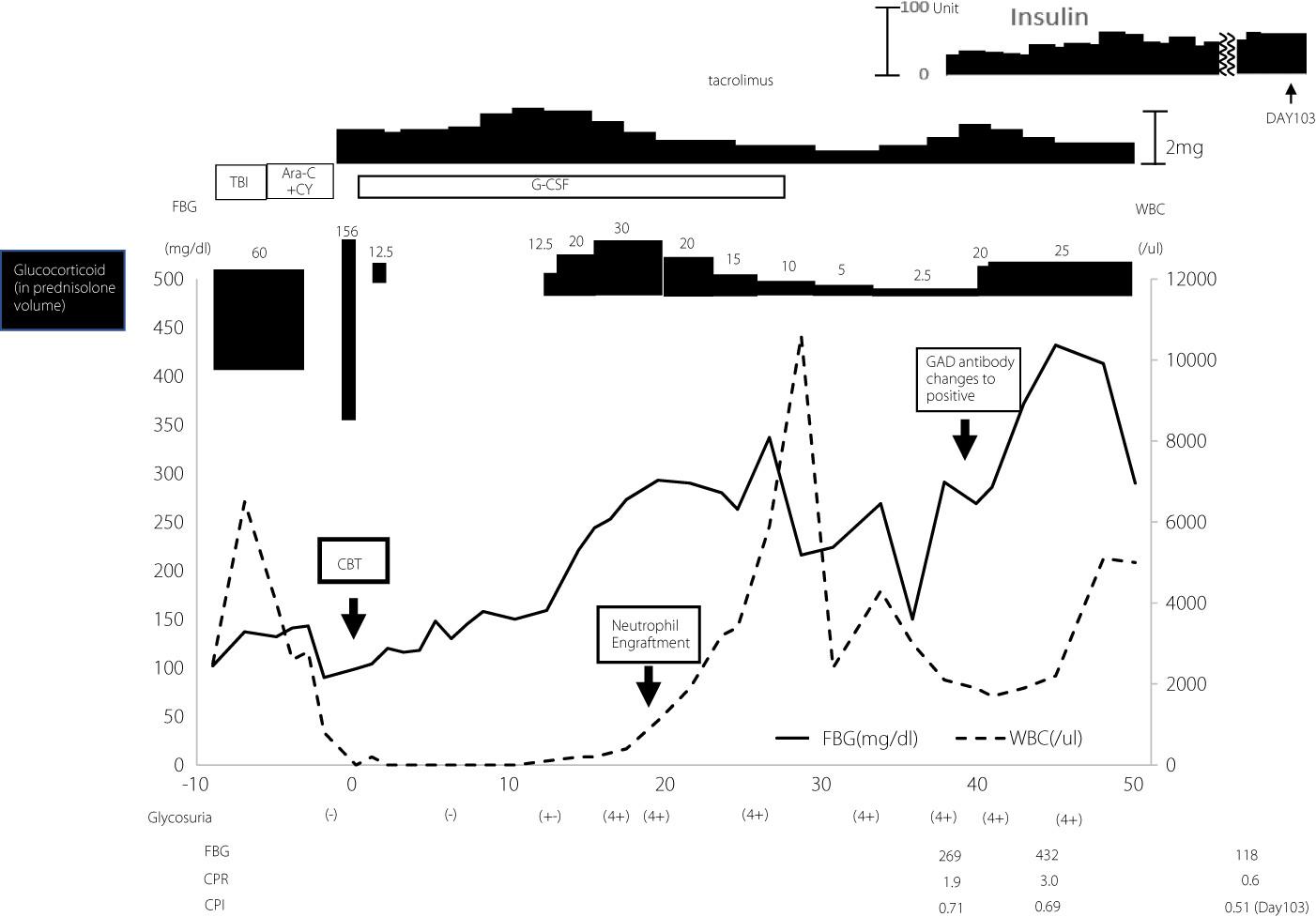 Type 1 diabetes mellitus after cord blood transplantation from an unrelated donor with a disease-sensitive haplotype