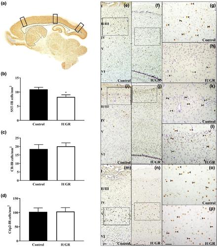 Excitatory and inhibitory neuron imbalance in the intrauterine growth restricted fetal guinea pig brain: Relevance to the developmental origins of schizophrenia and autism