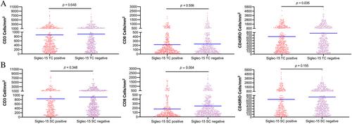 Significance of Siglec-15 expression in colorectal cancer: association with advanced disease stage and fewer tumor-infiltrating lymphocytes