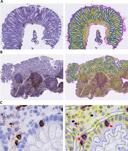 Deep learning-based image analysis reveals significant differences in the number and distribution of mucosal CD3 and γδ T cells between Crohn's disease and ulcerative colitis