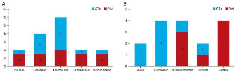 Dacryoendoscopic Findings of Patients with Lacrimal Drainage Obstruction Associated with Cancer Treatment.