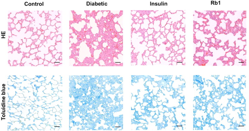 Ginsenoside Rb1 reduces oxidative/carbonyl stress damage and ameliorates inflammation in the lung of streptozotocin-induced diabetic rats.