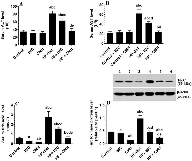 Camel milk protein hydrosylate alleviates hepatic steatosis and hypertension in high fructose-fed rats.