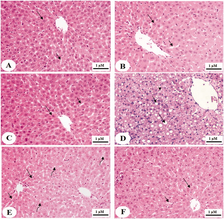 Camel milk protein hydrosylate alleviates hepatic steatosis and hypertension in high fructose-fed rats.