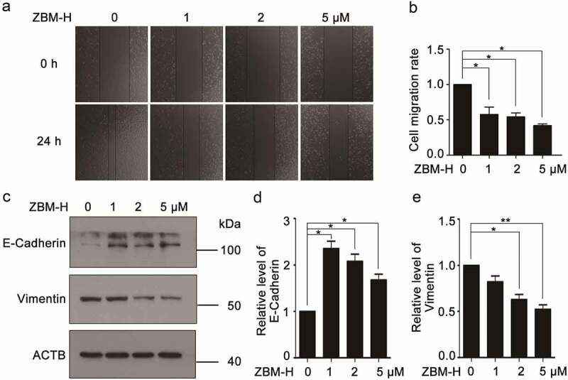 Activation of GRP78 ATPase suppresses A549 lung cancer cell migration by promoting ITGB4 degradation.