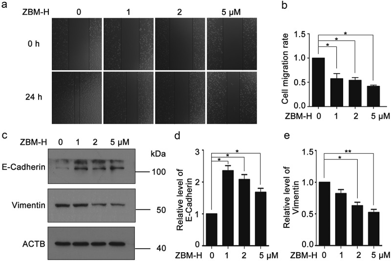 Activation of GRP78 ATPase suppresses A549 lung cancer cell migration by promoting ITGB4 degradation.