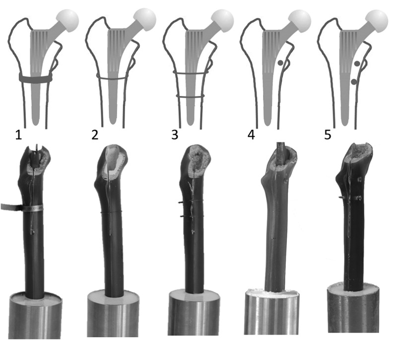 Biomechanical testing of different fixation techniques for intraoperative proximal femur fractures: a technical note.