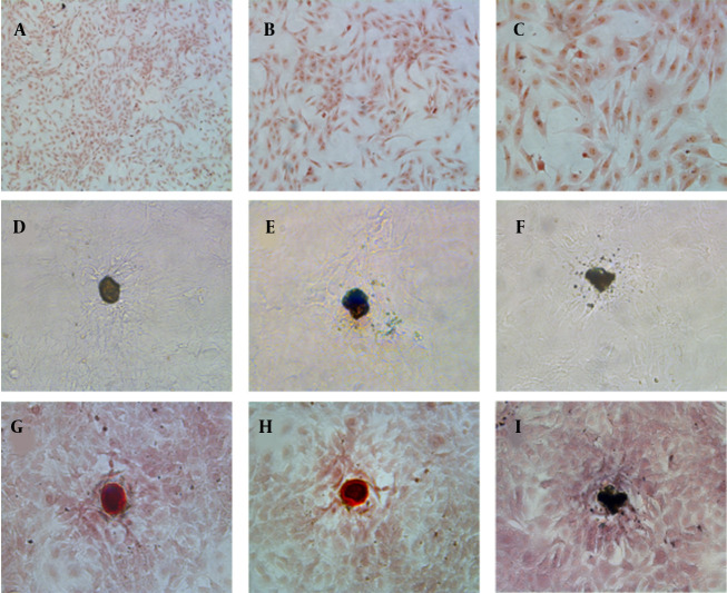 Icariin Exerts Estrogen-Like Actions on Proliferation of Osteoblasts in Vitro via Membrane Estrogen Receptors-Mediated Non-nuclear Effects.