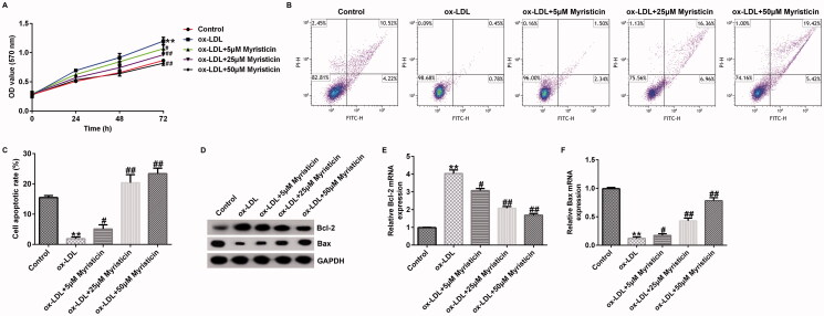 Myristicin regulates proliferation and apoptosis in oxidized low-density lipoprotein-stimulated human vascular smooth muscle cells and human umbilical vein endothelial cells by regulating the PI3K/Akt/NF-κB signalling pathway.