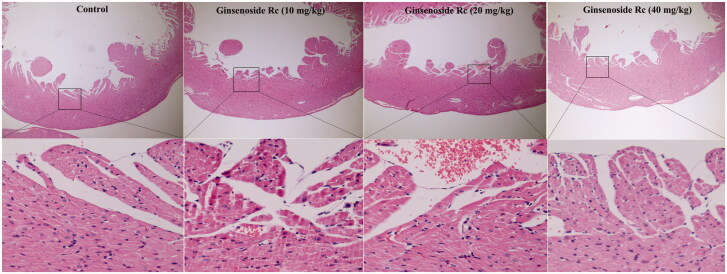 Ginsenoside Rc attenuates myocardial ischaemic injury through antioxidative and anti-inflammatory effects.