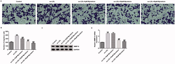 Myristicin regulates proliferation and apoptosis in oxidized low-density lipoprotein-stimulated human vascular smooth muscle cells and human umbilical vein endothelial cells by regulating the PI3K/Akt/NF-κB signalling pathway.