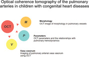 Optical coherence tomography of the pulmonary arteries in children with congenital heart diseases: A systematic review.