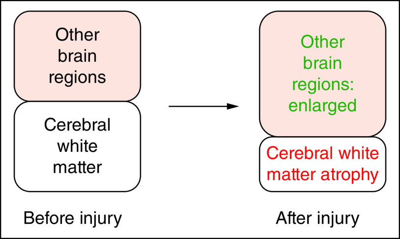 Journey to the other side of the brain: asymmetry in patients with chronic mild or moderate traumatic brain injury.