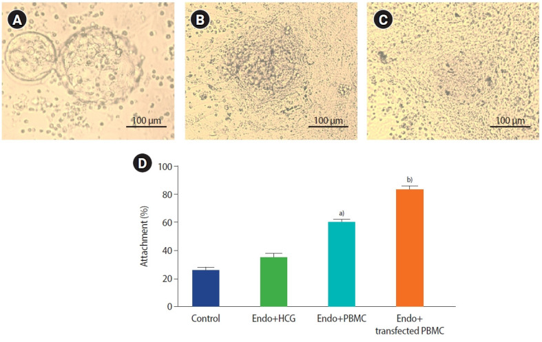 Effects of human chorionic gonadotropin-producing peripheral blood mononuclear cells on the endometrial receptivity and implantation sites of the mouse uterus.