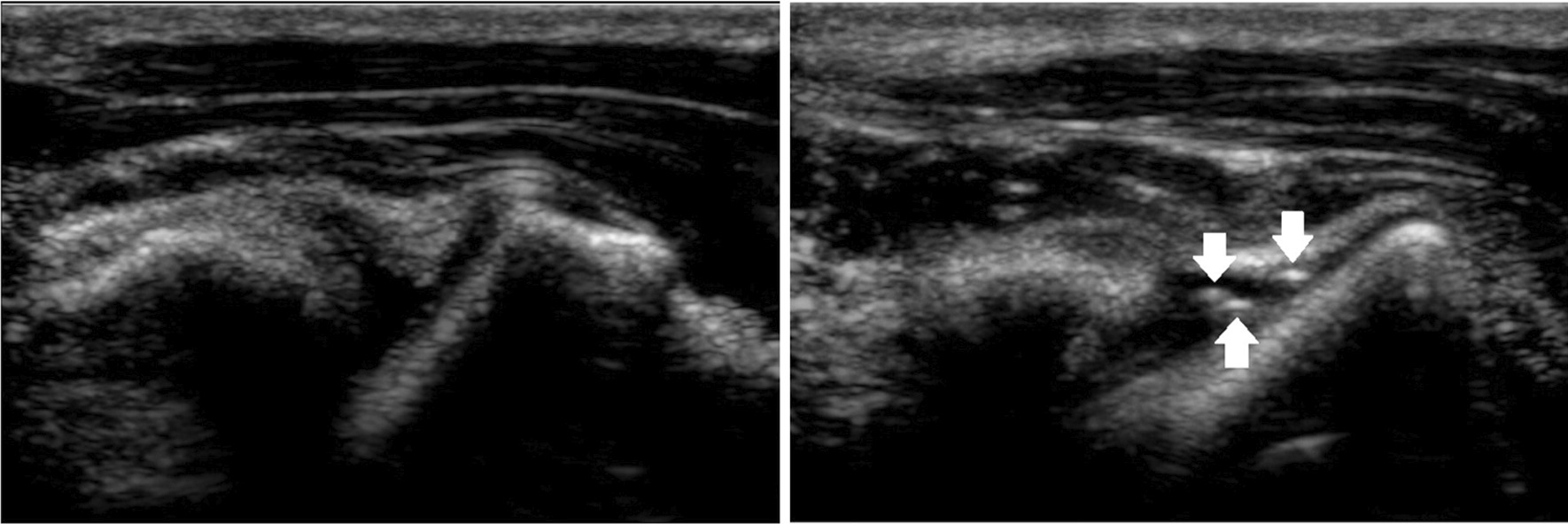 Why is the prevailing model of joint manipulation (still) incorrect?