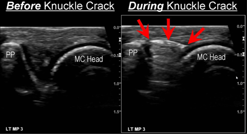 Why is the prevailing model of joint manipulation (still) incorrect?