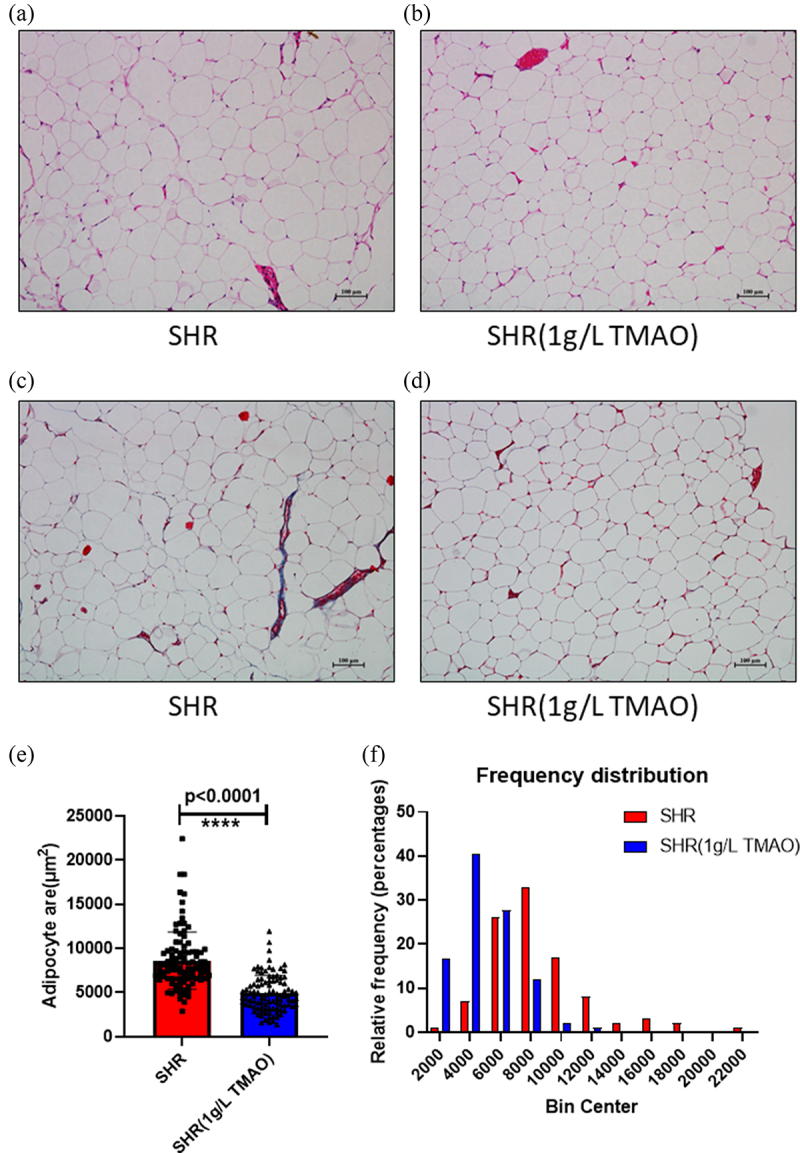 The effect of trimethylamine N-oxide on the metabolism of visceral white adipose tissue in spontaneously hypertensive rat.