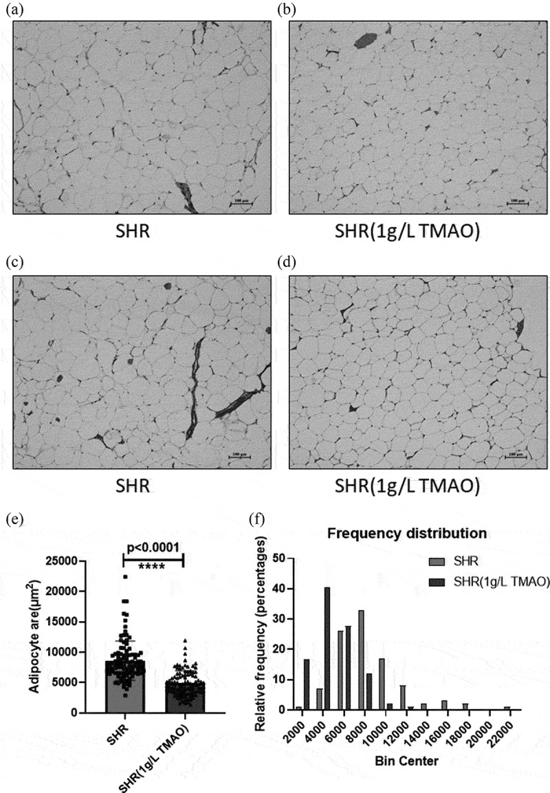 The effect of trimethylamine N-oxide on the metabolism of visceral white adipose tissue in spontaneously hypertensive rat.