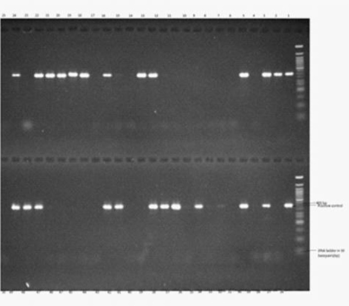 EVALUATION OF PHENOTYPIC AND MOLECULAR TECHNIQUE IN THE DETECTION OF EXTENDED SPECTRUM BETA-LACTAMASE (ESBL)-PRODUCING GRAM NEGATIVE BACILLI IN OGUN STATE, NIGERIA.