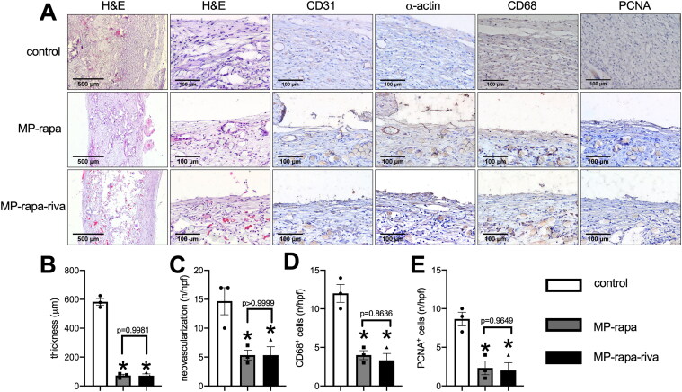 Delivery of rivaroxaban and chitosan rapamycin microparticle with dual antithrombosis and antiproliferation functions inhibits venous neointimal hyperplasia.