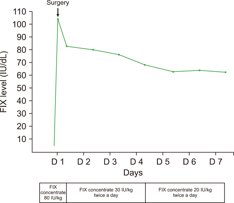 Rapid development of lower leg compartment syndrome following firearm injury in a patient with moderate hemophilia B.