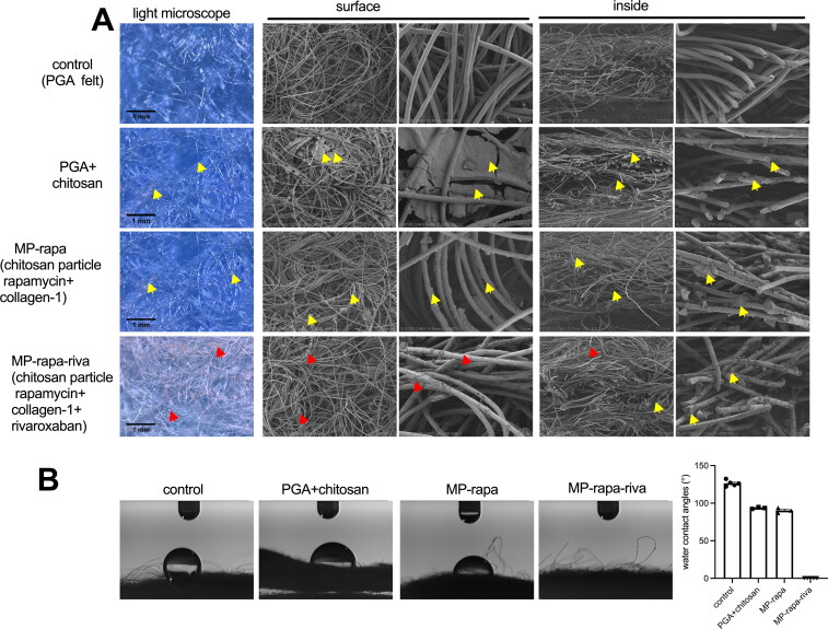 Delivery of rivaroxaban and chitosan rapamycin microparticle with dual antithrombosis and antiproliferation functions inhibits venous neointimal hyperplasia.