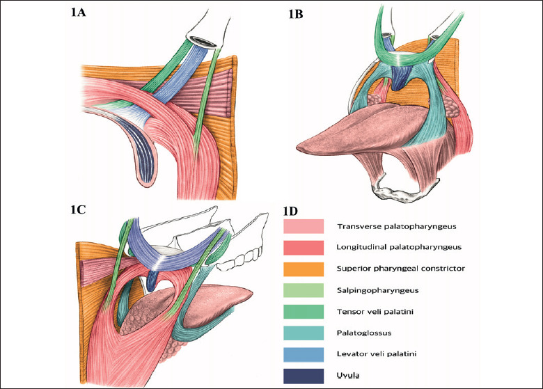 Role of functional and anatomic study in sleep endoscopy for treatment of OSA.