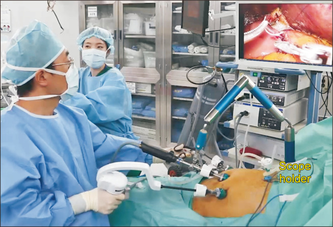 Usefulness of the new articulating laparoscopic instrument in laparoscopic pancreaticoduodenectomy.