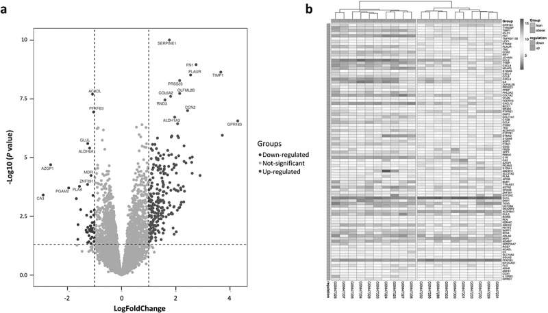 Identification of key genes and their association with immune infiltration in adipose tissue of obese patients: a bioinformatic analysis.