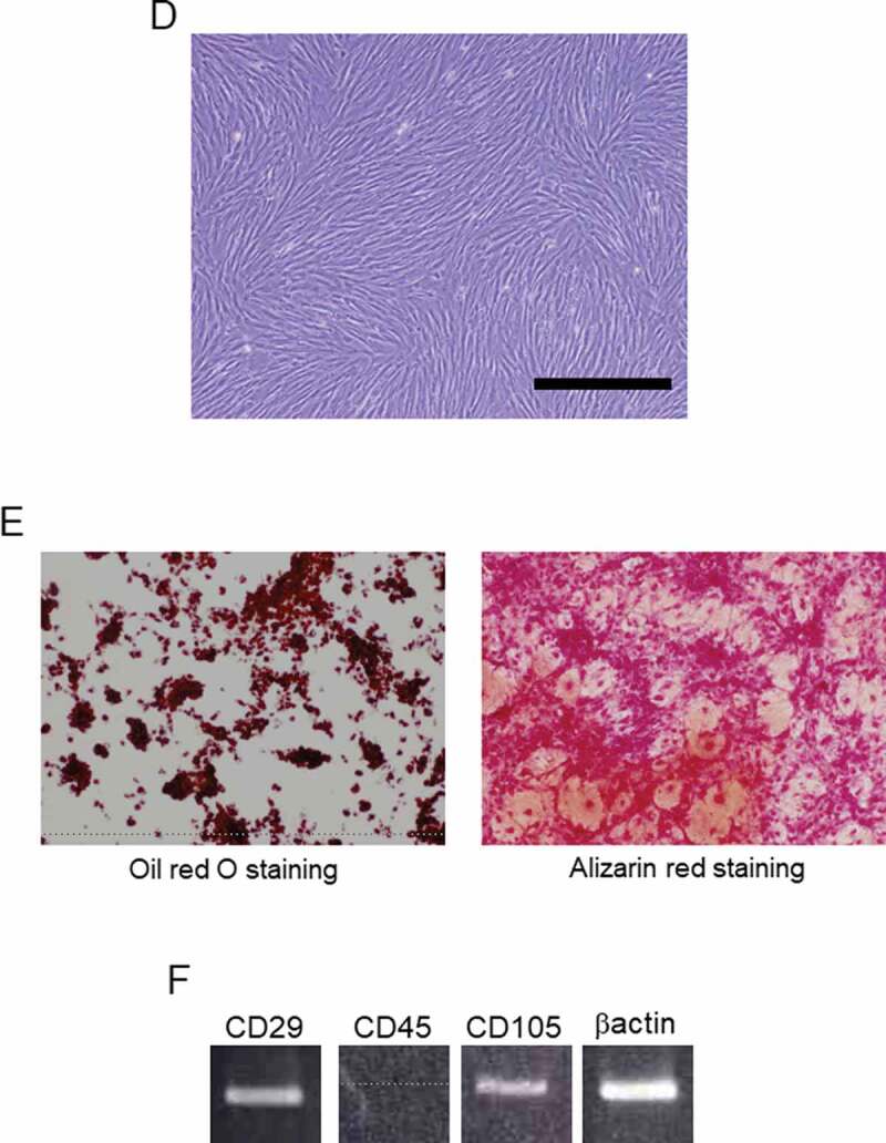 Mesenchymal Stem Cells Secretions Enhanced ATP Generation on Isolated Islets during Transplantation.